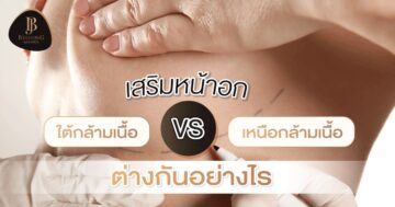 เสริมหน้าอก ใต้กล้ามเนื้อ เหนือกล้ามเนื้อ ต่างกันอย่างไร?