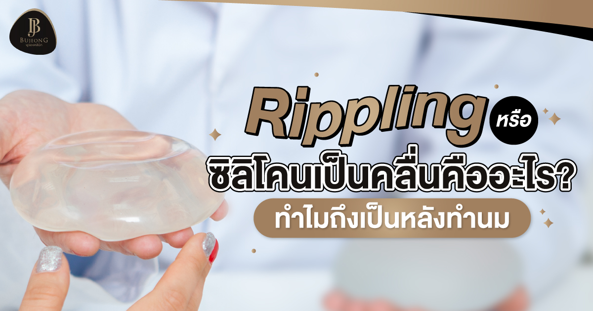 Rippling หรือ ซิลิโคนเป็นคลื่น หลังทำนม คืออะไร?